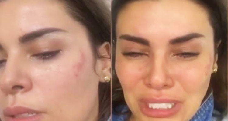 الاحتفاظ بمتعهد الحفلات المتهم بالاعتداء على الفنانة أماني السويسي