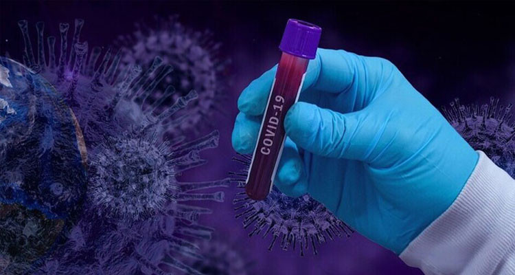 تسجيل 22 اصابة جديدة بفيروس كورونا، 10 منها محلية