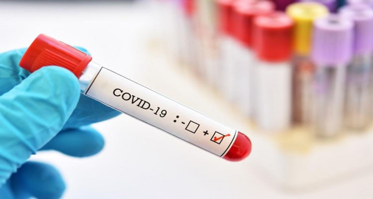 وزارة الصحة تعلن تسجيل 376 حالة إصابة جديدة بفيروس كورونا