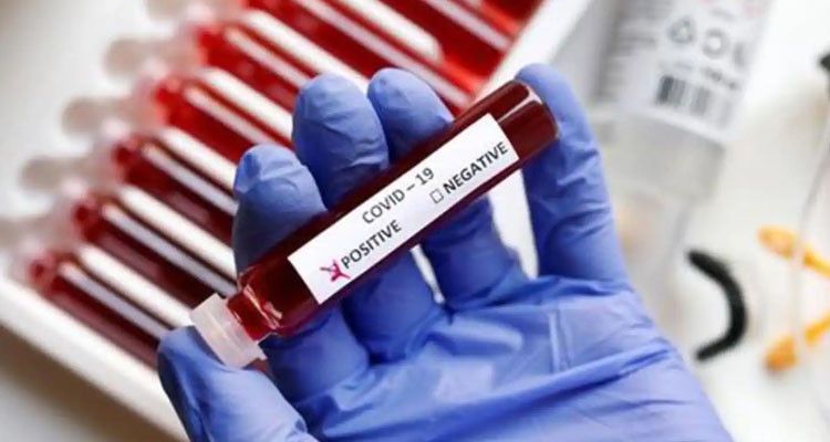 ثبوت إصابة شخصين للمرة الثانية بفيروس كورونا في مدنين