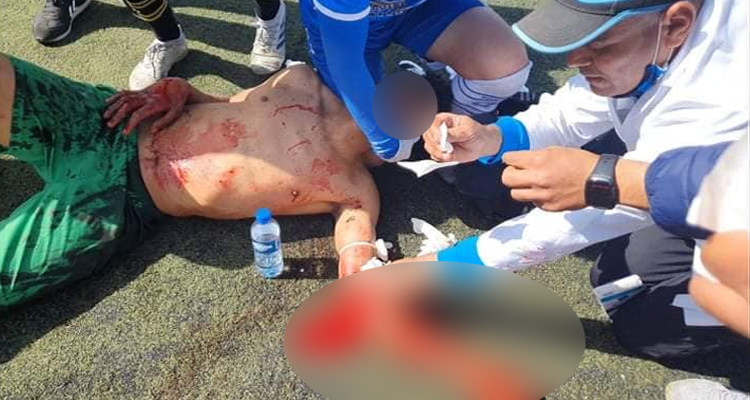 قرقنة: اعتداء على لاعب تالة استوجب نقله بالطائرة لإجراء تدخل جراحي عاجل؟