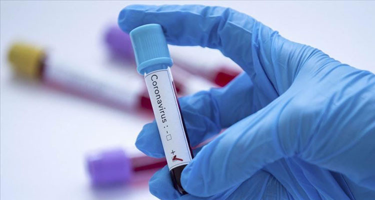 بن عروس: تسجيل 30 إصابة جديدة بفيروس كورونا