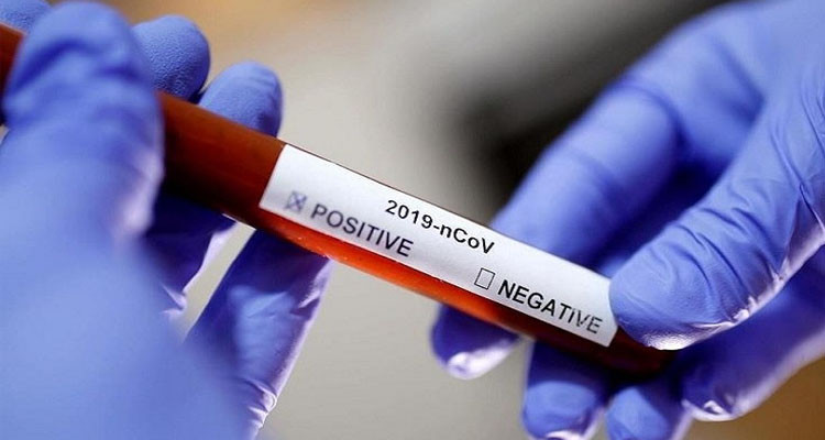 صفاقس-كوفيد19: تسجيل 5 وفيات جديدة و136 إصابة مقابل 249 حالة 