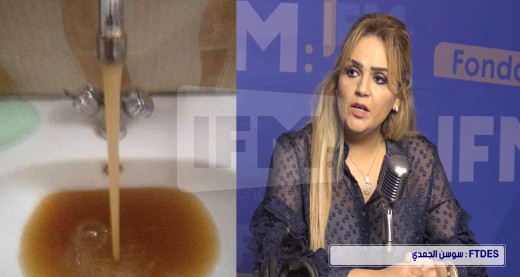 سوسن الجعدي: أهالي حاجب العيون ماء الصوناد يهبطلهم فيه نسبة عالية مالصديد