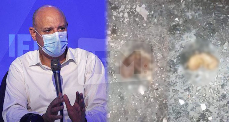 كاتب عام عمادة الأطباء: الأجنة قدم ينجمو يكونوا محنطين والطبيب مش طبيب نساء