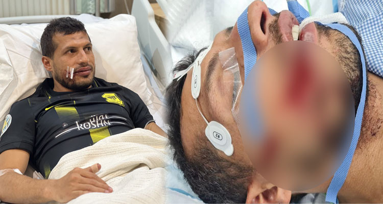 نشر صورة صادمة بعد إصابته: المصري طارق حامد يطمئن متابعيه