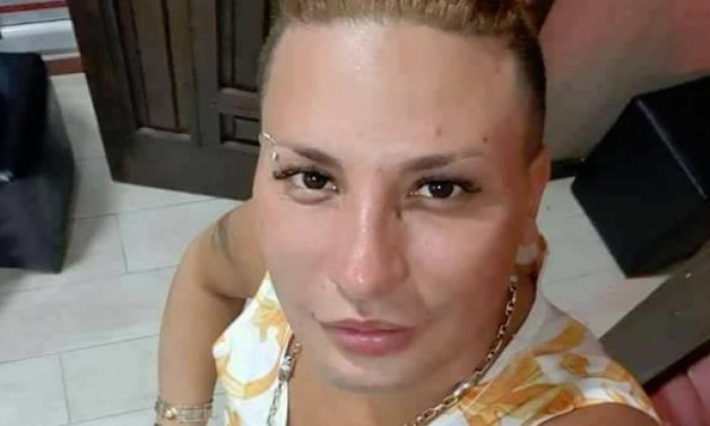وفاة فنان راي جزائري مثير للجدل أثناء إجراء عملية تجميل