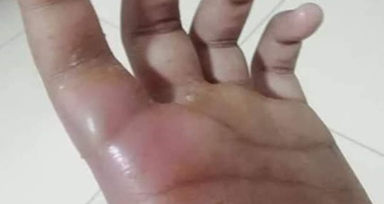 معلم يكسر اصابع تلميذة