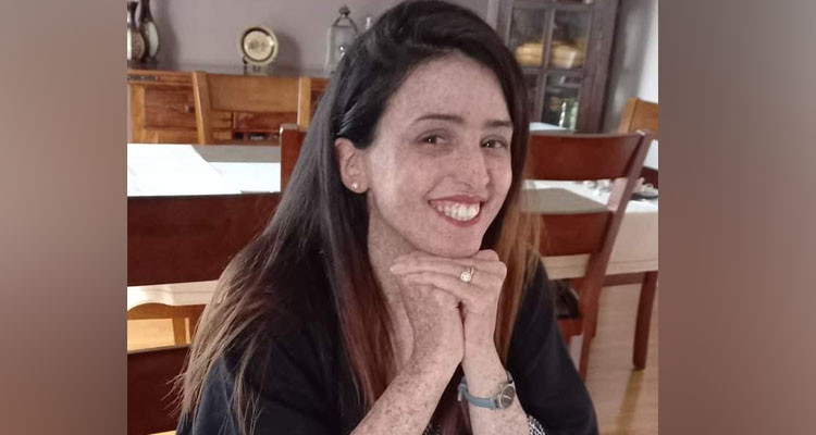 لمياء حكيم أول طفلة قمر في العالم تناقش الدكتوراه: "حاولت نحوّل الألم إلى أمل"