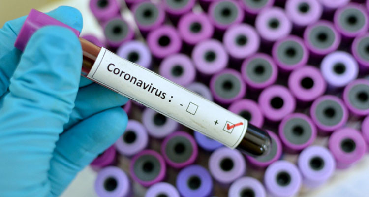 اصابات جديدة بالكورونا