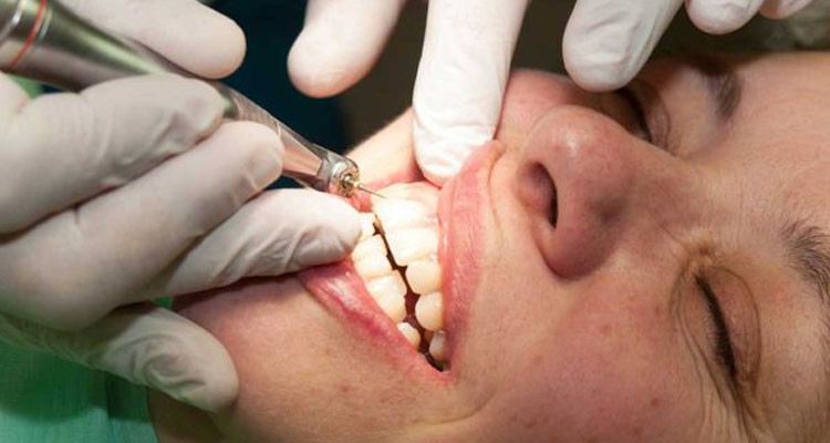 منع استعمال ملغم الأسنان عند الأطفال دون سن الـ 15 والحوامل والمرضعات
