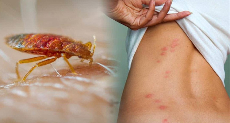 حشرة "البق" تغزو شوارع باريس