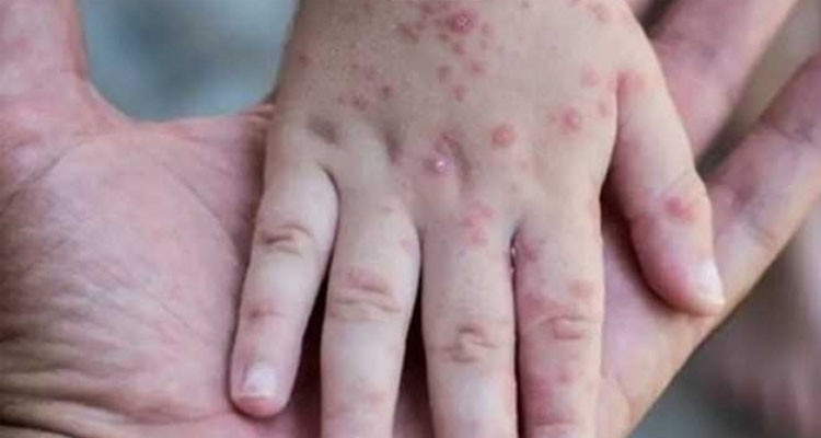 ليبيا تعلن حالة الطوارئ الصحية