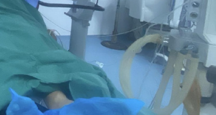 مدنين: 56 منتفعا بعمليات إزالة الماء الأبيض من العيون مجانا