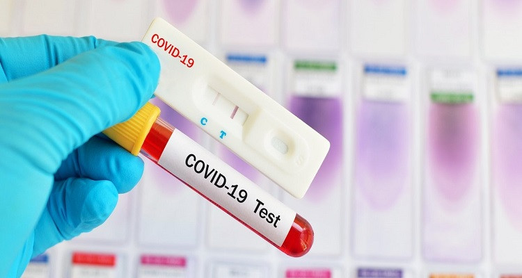 فيروس كورونا اختبار