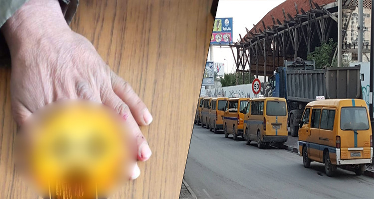 سائق سيارة تاكسي جماعي يعنّف مواطنا ويبتر أحد أصابع يده  