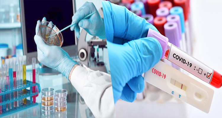 سعر تحاليل تقصي كورونا