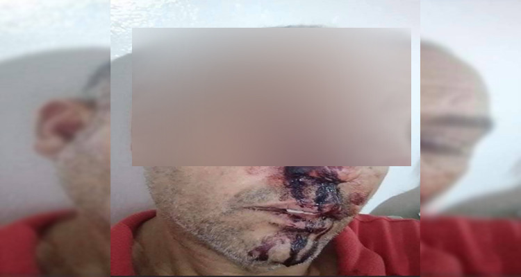 اعتداء على إطار امني سام