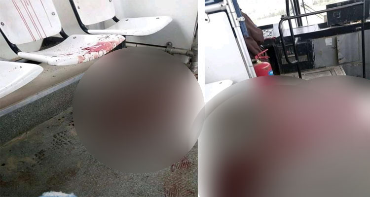 تلميذ الثامنة أساسي يشوّه وجه ورقبة زميلته بآلة حادة 