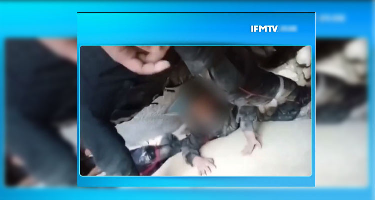 الحماية المدنية تنتشل مواطنا أصيب بكسور بعد انهيار أحد المباني 