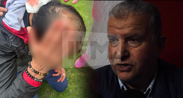مراد الفرشيشي: السايبي قام بمسرحية ووضع قطرات من الصبغ على رأسه