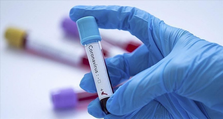 coronavirus