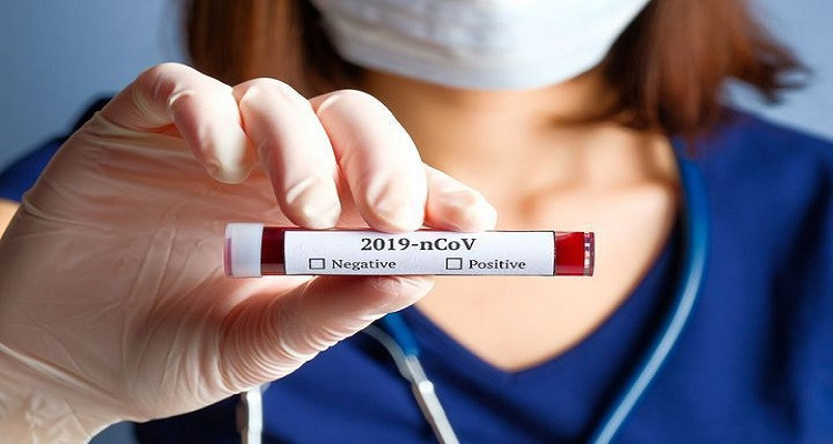 coronavirus