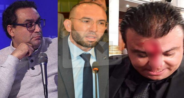 شكيب: حمقى ائتلاف الكرامة يمهدون بحمقهم لتفعيل الفصل 80