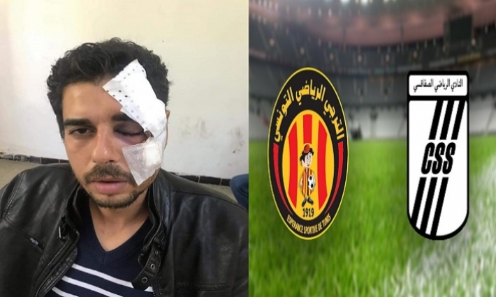 قنبلة غاز تحرم هشام الحديجي من نعمة البصر وتسبب له 5 كسور في الوجه (فيديو) 