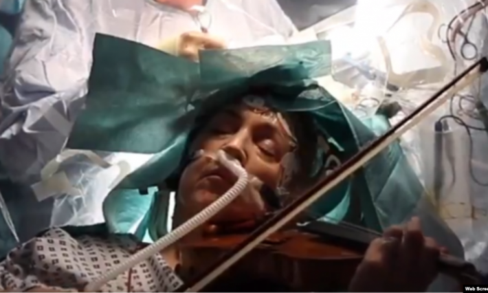 فيديو مؤثر من داخل غرفة العمليات.. سيدة تعزف الكمان أثناء إزالة ورم من دماغها