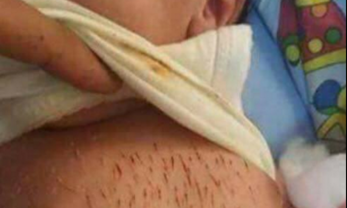 بسبب "التشليط": وفاة رضيعين في القيروان ومندوبية حماية الطفولة تتدخل
