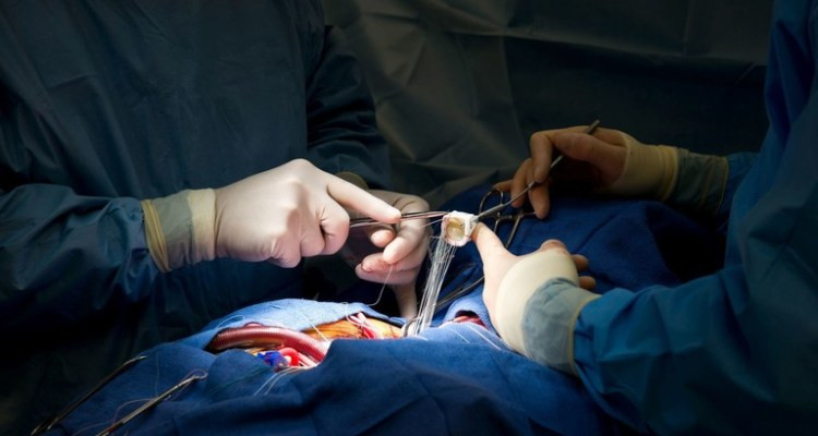 الأولى من نوعها  في تونس : فريق طبي بمستشفى سهلول يجري عملية قلب مفتوح لرضيع يعاني من تشوهات خلقية