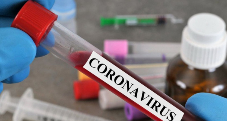 وزارة الصحة: تسجيل إصابة جديدة وافدة بفيروس كورونا