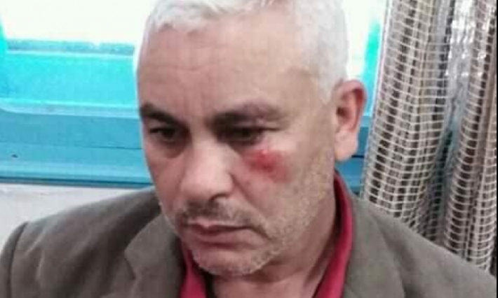 جندوبة: اعتداء بالعنف الشديد على فريق الطب المدرسي بغار الدماء