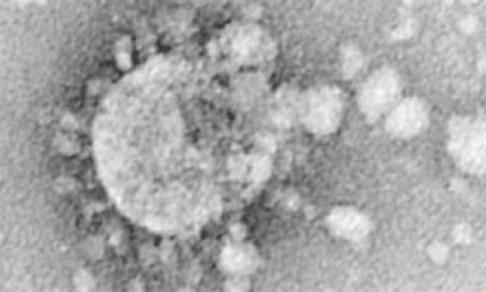 صورة لفيروس كورونا تحت المجهر