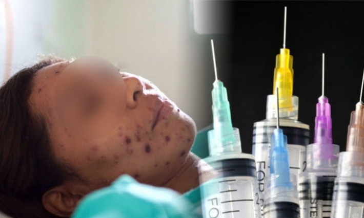 بداية من مارس المقبل في تونس: حملة تلاقيح ضد الحصبة لمن تتراوح أعمارهم بين 18 و35 سنة