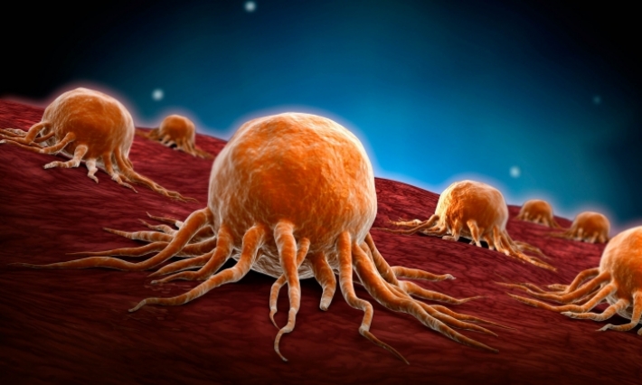 مؤسس الجمعية التونسية لمكافحة السرطان: 40 حالة جديدة لمرض السرطان يوميا في تونس 