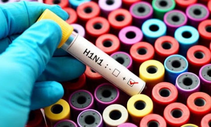 المدير الجهوي للصحة بالقصرين: ثبوت إصابة سيدة بفيروس انفلونزا الخنازير