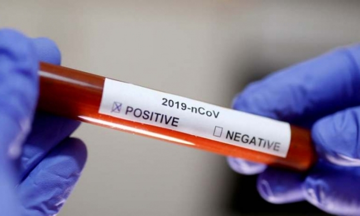 كورونا يضرب التعليم وكرة القدم في إيطاليا