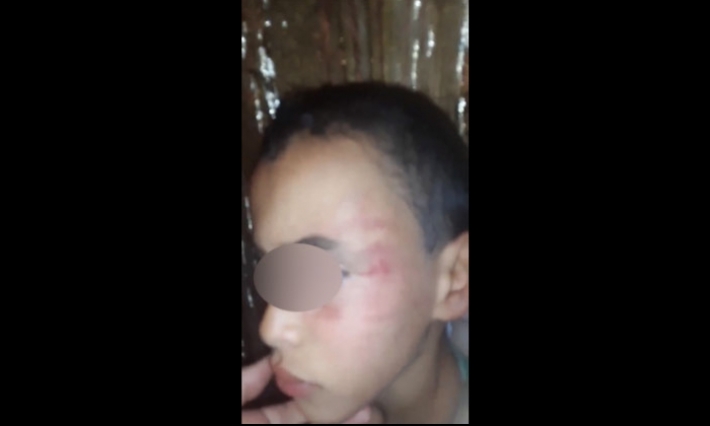 المنستير: فتح تحقيق حول قيام مدرّس بتعنيف تلميذ خلال حصة دروس خصوصية في قصرهلال