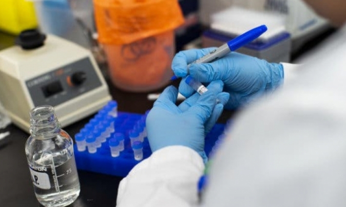 أول حالة وفاة بالكورونا في بلجيكا