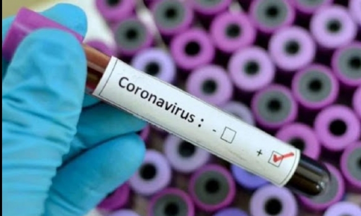 الجزائر تسجيل ثاني حالة إصابة بفيروس كورونا 