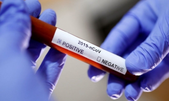 شكري حمودة: عدد المصابين بالكورونا في تونس مرجح للارتفاع