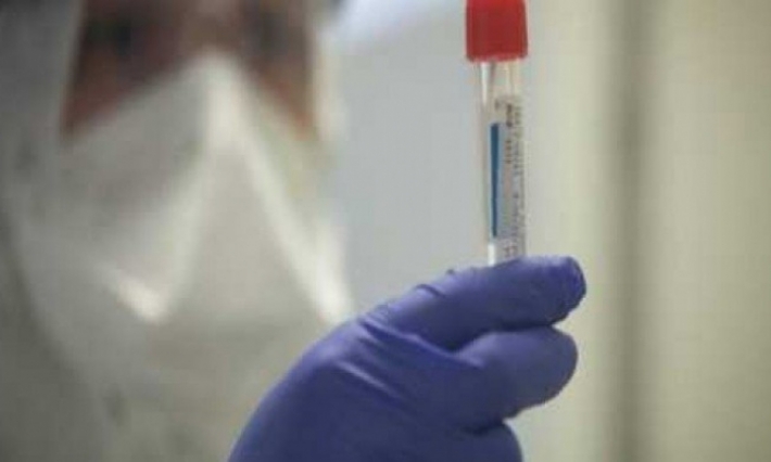 كورونا: تحاليل 3 مشتبه بإصابتهم في تطاوين سلبية