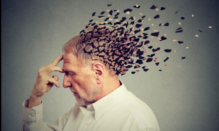 مرضى الزمهايمر فئة هشة تتأثر بشدة بالكورونا