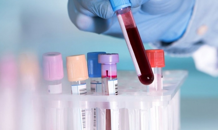 وزارة الصحة: النتيجة السلبية للتحاليل لا تعفي من استكمال مدة الحجر الصحي