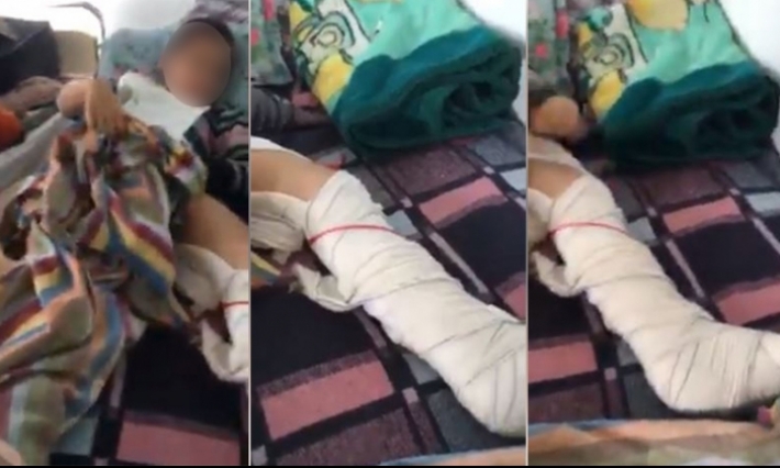 استاذ يعنف تلميذ ويتسبب له في كسر على مستوى الساق لأنه نسي كراسه