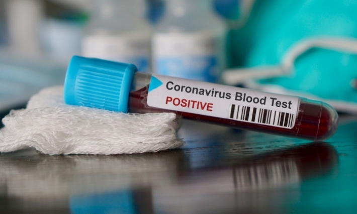 المدير الجهوي للصحة بصفاقس يؤكد لإي أف أم تسجيل أول حالة إصابة بالكورونا في الجهة  