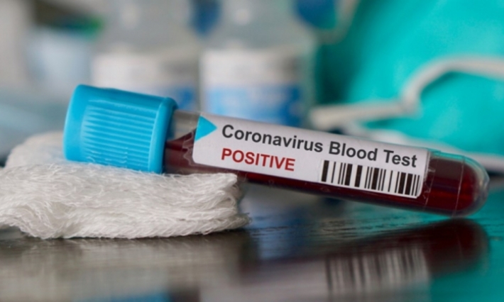 المهدية: تطبيق العزل الصحي على 37 شخصا تواصلوا مباشرة مع المصاب الثاني بفيروس كورونا