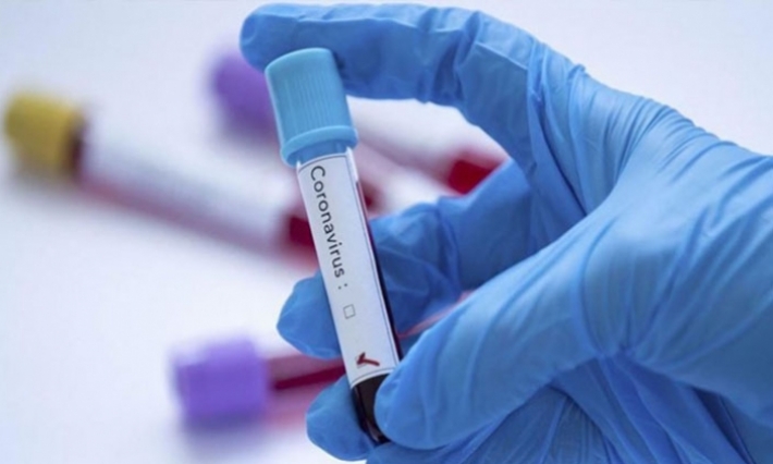 قابس: أخذ عيّنات من عائلة لإجراء تحليل مختبري يخصّ فيروس كورونا